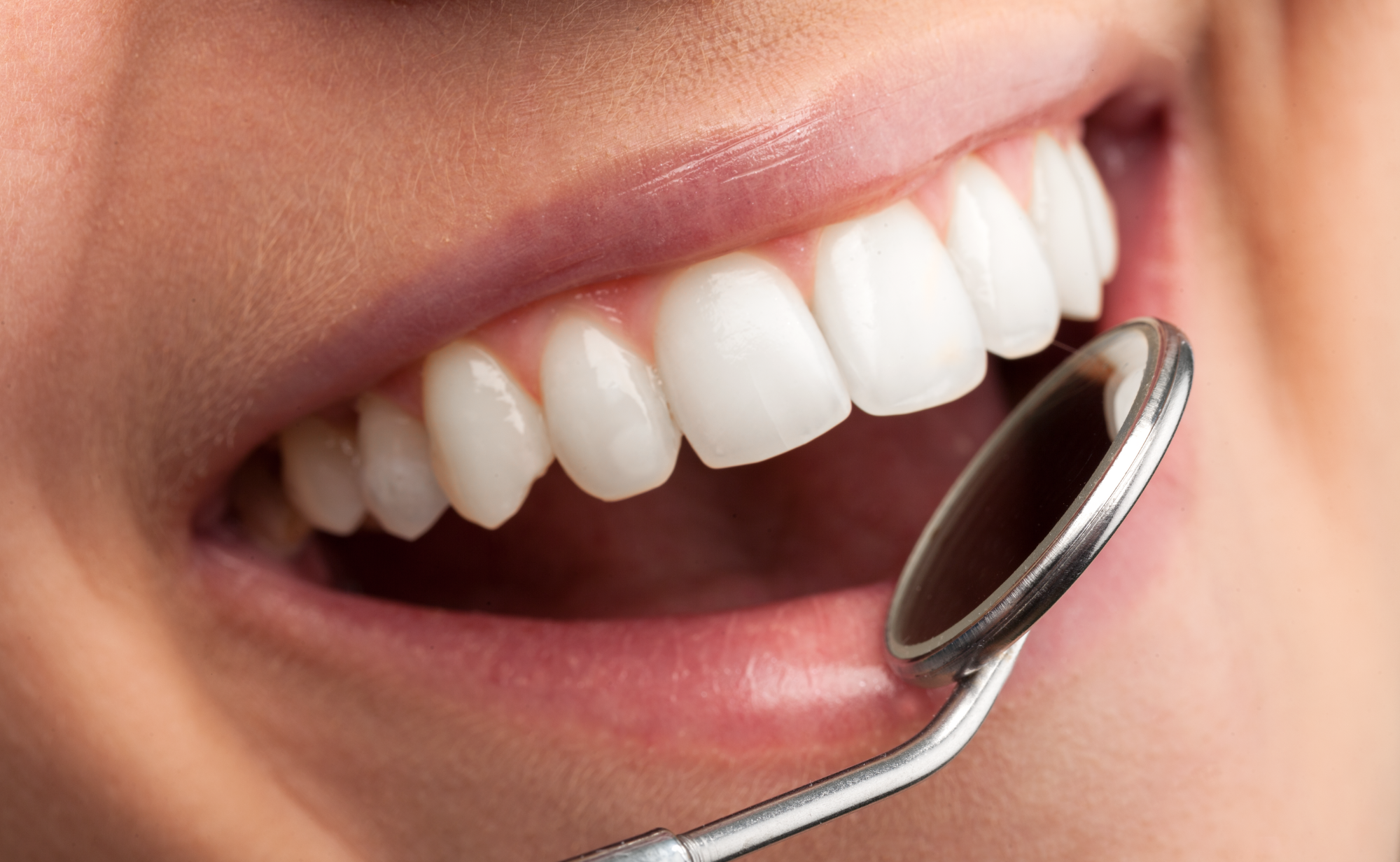 How Much Is Periodontal Treatment in Ireland?